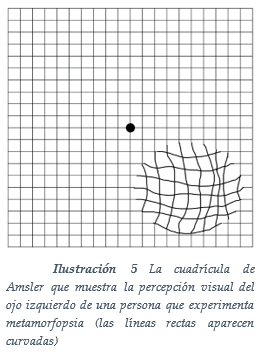 Retícula de Amsler